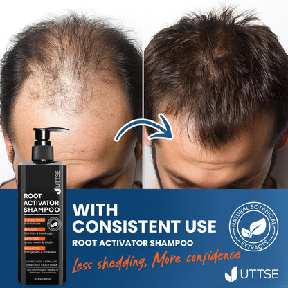 Uttse Root Activator Shampoo for Men – Hair Growth & Thicker Hair (300 mL)