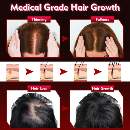 UUPAS Hair Growth Device – FDA Cleared Laser Red Light Therapy Cap for Hair Regrowth