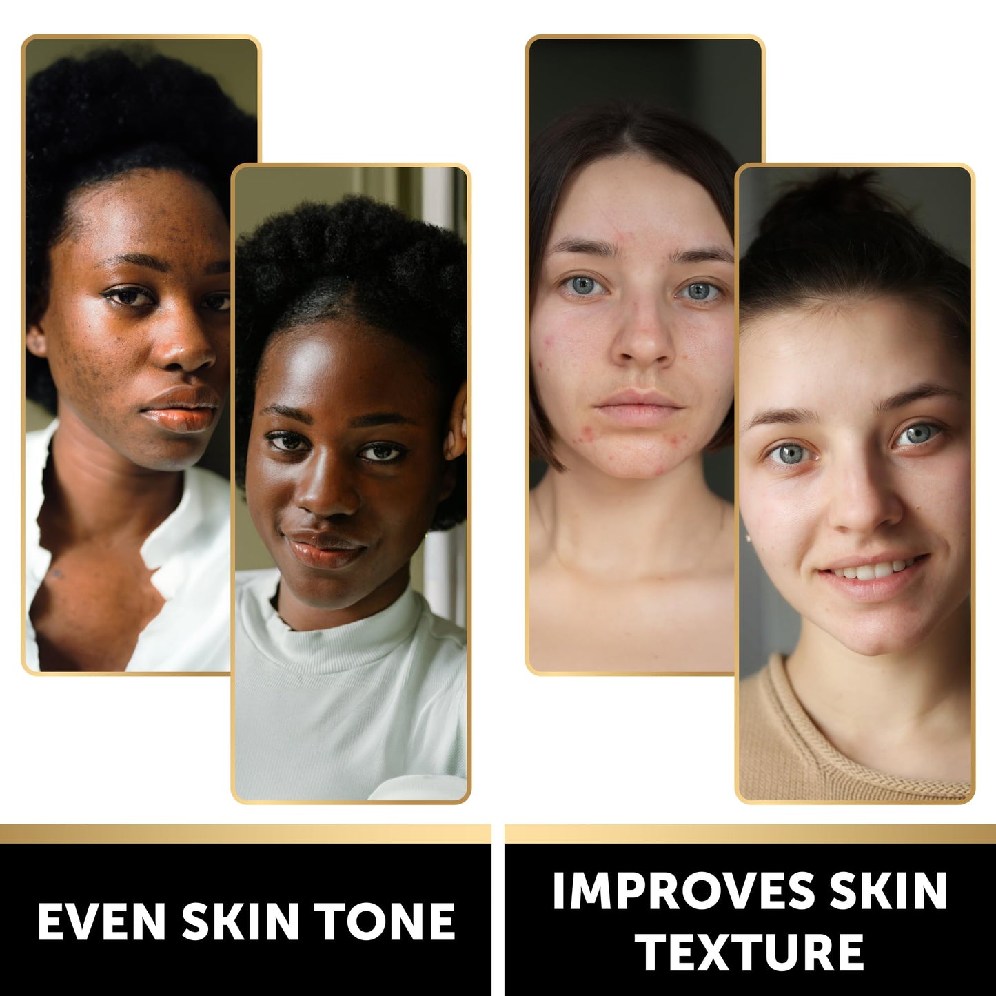 VALITIC Charcoal Kojic Acid Turmeric Bar — 2 Pack for Dark Spots and Even Skin Tone
