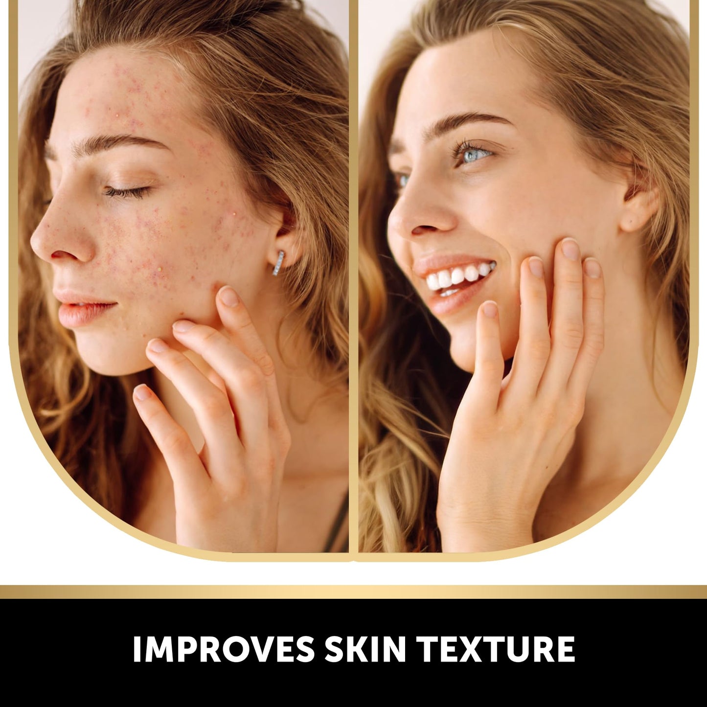 VALITIC 2-Pack Kojic Acid Dark Spot Corrector Soap Bars — Vitamin C, Retinol, Hyaluronic Acid + Exfoliating Gloves