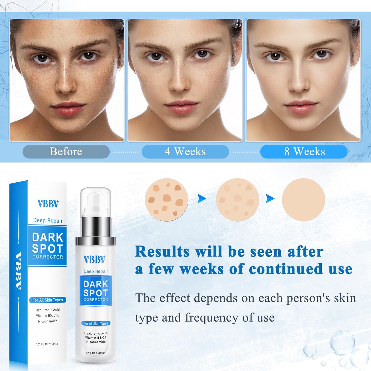 VBBV Dark Spot Remover for Face & Body – Hyperpigmentation Corrector, 1.7 oz