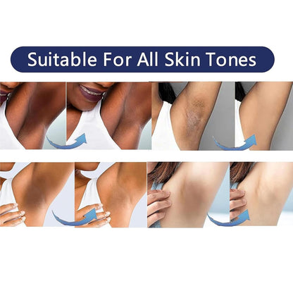 Vcetree Skin Bleaching Cream for Intimate Areas | Gentle Lightening & Even Tone (1 oz)