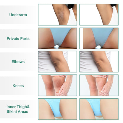 VCETree Skin Bleaching Cream for Intimate Areas – Lighten & Even Skin Tone (1.7 fl oz)