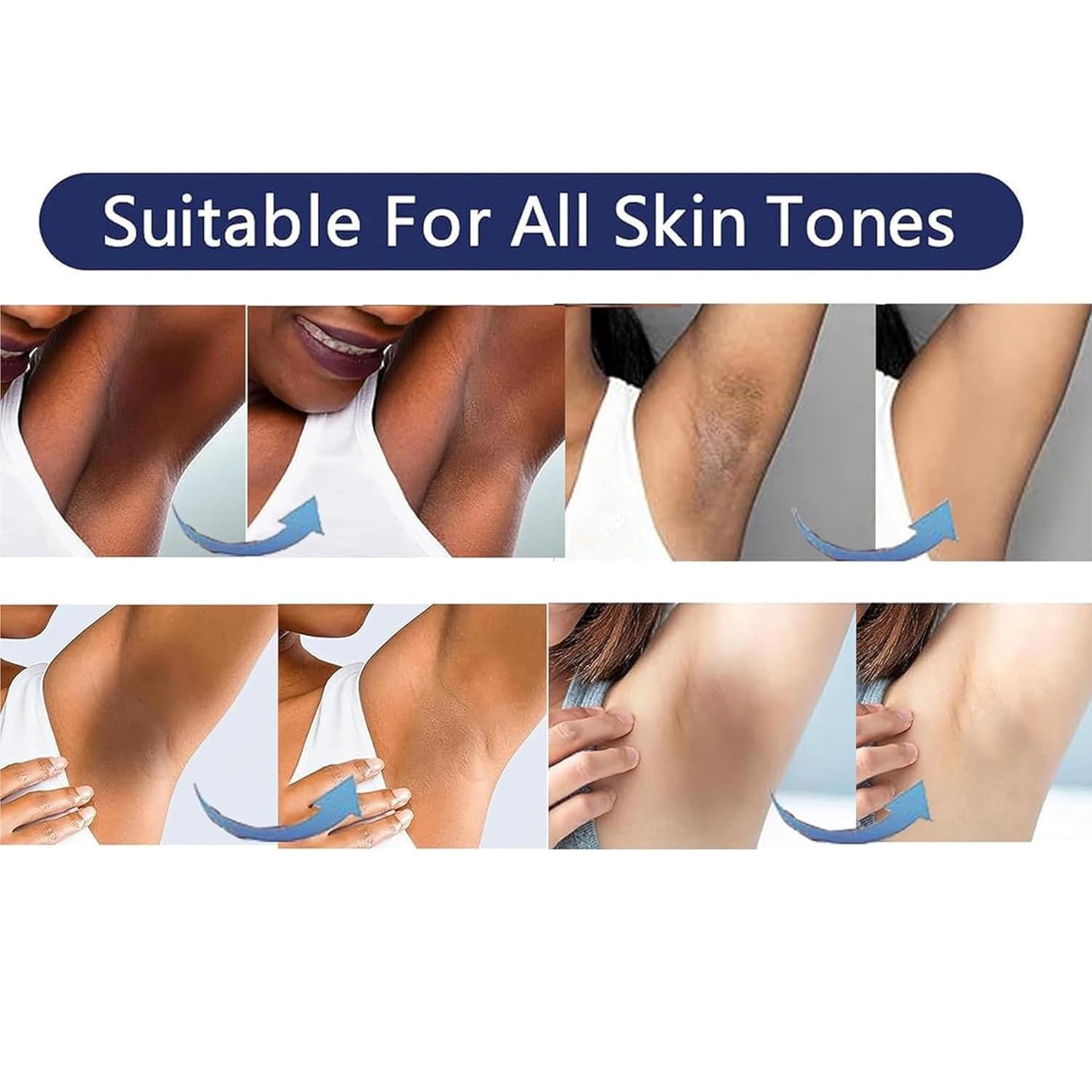 VCETree Skin Bleaching Cream for Intimate Areas – Lighten & Even Skin Tone (1.7 fl oz)