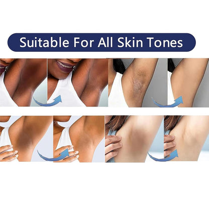 VCETree Skin Bleaching Cream for Intimate Areas – Lighten & Even Skin Tone (1.7 fl oz)