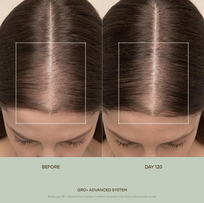 VEGAMOUR GRO+ Advanced Hair Serum 3-Pack – Improve Density, Reduce Shedding, Healthy Scalp