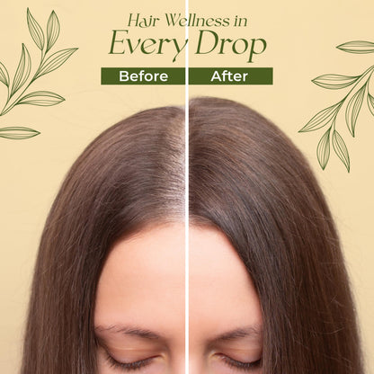 Veganic Hair Growth Oil for Women — 11 Botanicals, Non-GMO, 30-Day Supply