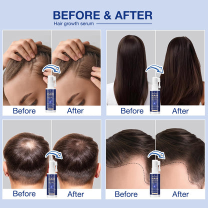 VENANOCI Hair Growth Oil Spray – Natural Regrowth Serum with Rosemary & Biotin for Thinning Hair