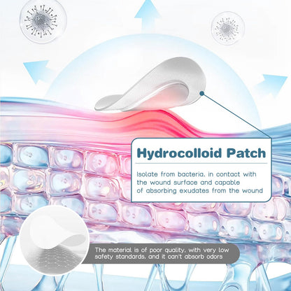 Venrock Pimple Patches — 48 Hydrocolloid Patches in 24 Cute Animal Shapes