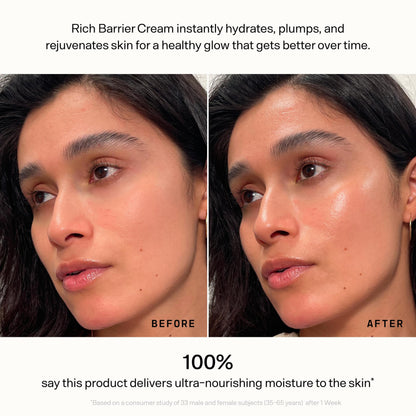 Versed Daily Recovery Rich Barrier Cream – Hydrating Face Moisturizer for Dry, Sensitive Skin | 1.5 oz