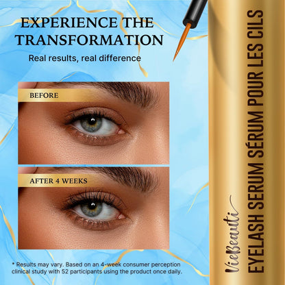 VieBeauti Lash Serum for Eyelash Growth – 5mL, 5-Month Supply, Vegan & Cruelty-Free
