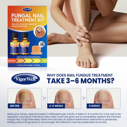 VigorWell Toenail Treatment Extra Strength – Dual Action Nail Repair Kit (30 ml Gel + 32 Patches)