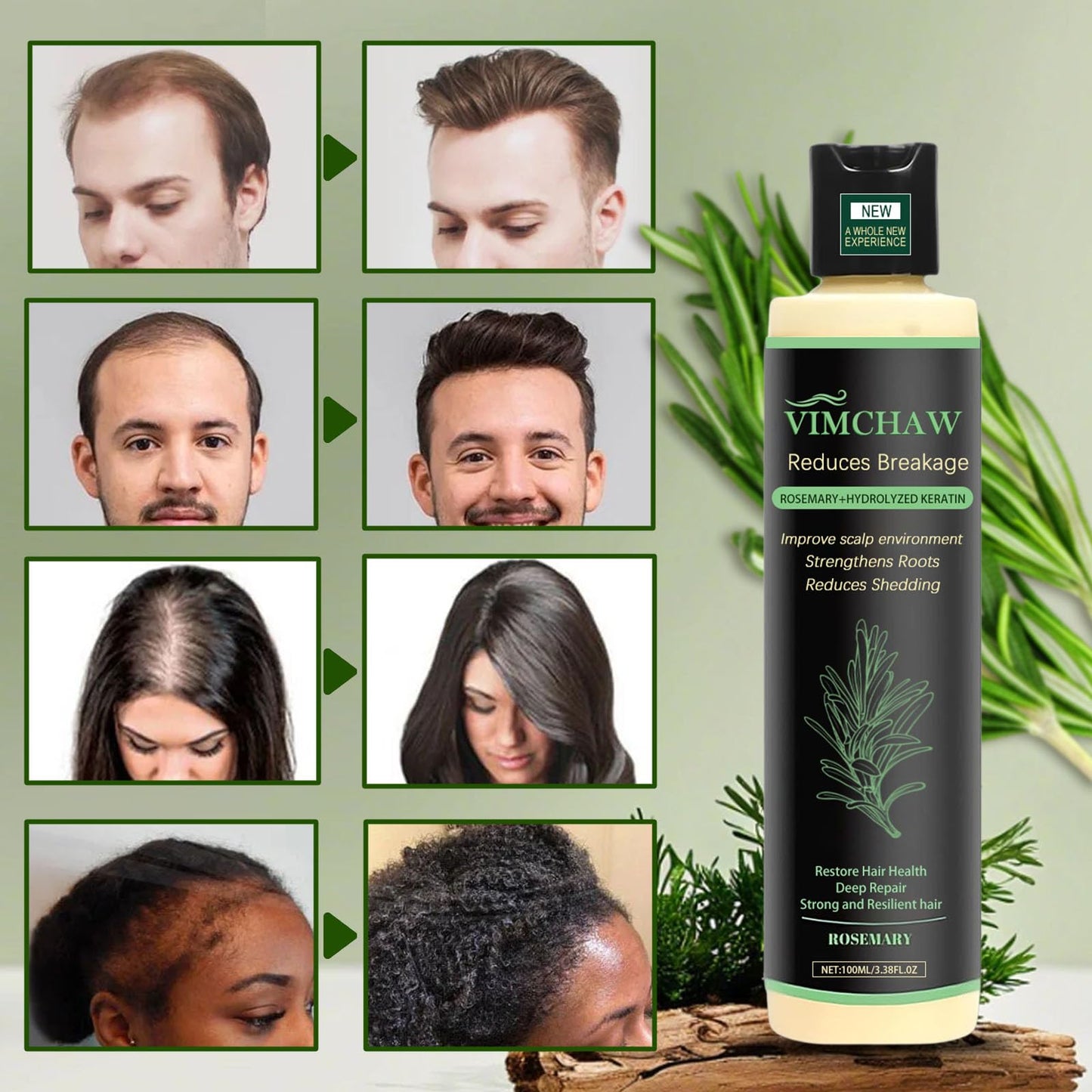 Vimchaw Organic Rosemary Hair Growth Shampoo – Strengthening with Hydrolyzed Keratin