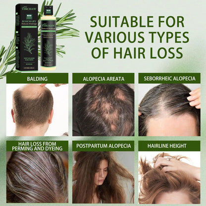 Vimchaw Organic Rosemary Hair Growth Shampoo – Strengthening with Hydrolyzed Keratin