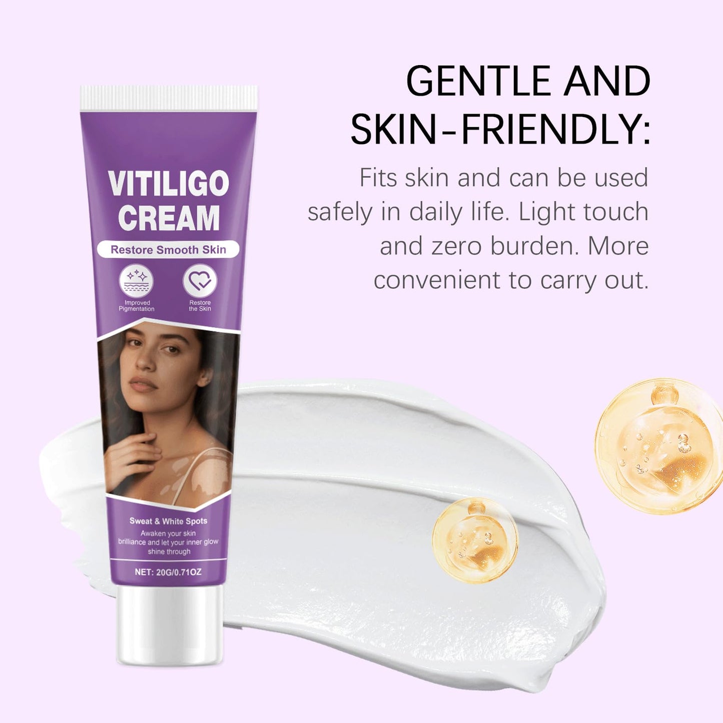 Vitiligo Cream – Natural Skin Pigmentation Support (2-Pack)