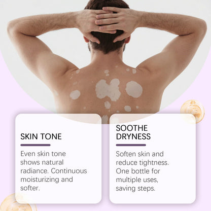 Vitiligo Cream – Natural Skin Pigmentation Support (2-Pack)