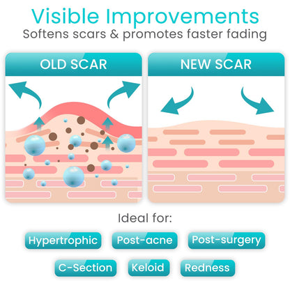 Vive Care Silicone Scar Sheets Tape – 1.6 inch x 120 inch Roll – Medical-Grade, Waterproof & Reusable