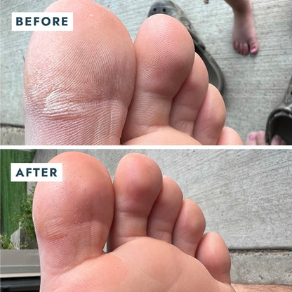 VOESH Solemate Heel Repair Balm – Deep Moisture for Rough Heels