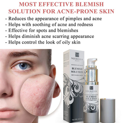 Voibella Beauty Blemish Spot Treatment Cream – Gentle Serum for Acne-Prone Skin