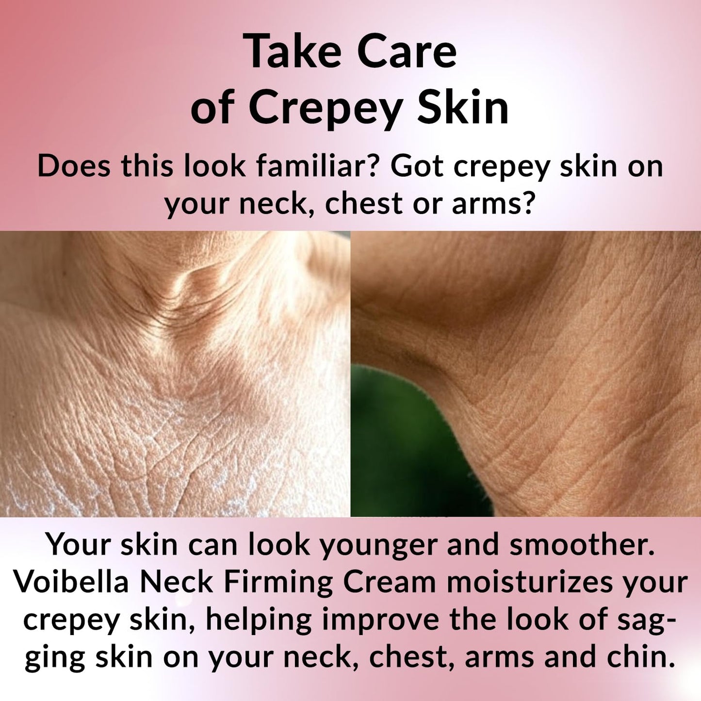 VOIBELLA BEAUTY Neck Firming Cream – Tighten Crepey Skin & Décolletage
