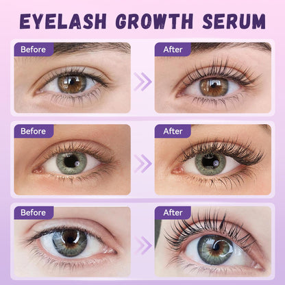 Vxzit Lash Serum | Gentle Natural Vegan Eyelash Growth & Nourishing Treatment 5ml