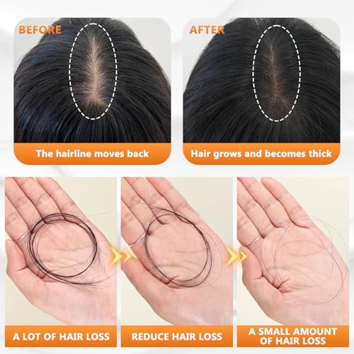 Wanban Anti Hair Loss Shampoo – Routine Shampoo for Women, Supports Healthy-Looking Hair (2pcs)