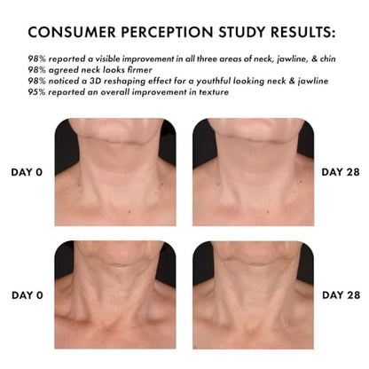 Whish Neck Firming Cream with Bakuchiol – 3D Neck Reshaping (3.4oz)