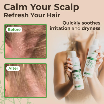 Wild Naturals Anti-Dandruff & Seborrheic Dermatitis Shampoo + Conditioner Set for Itchy Scalp