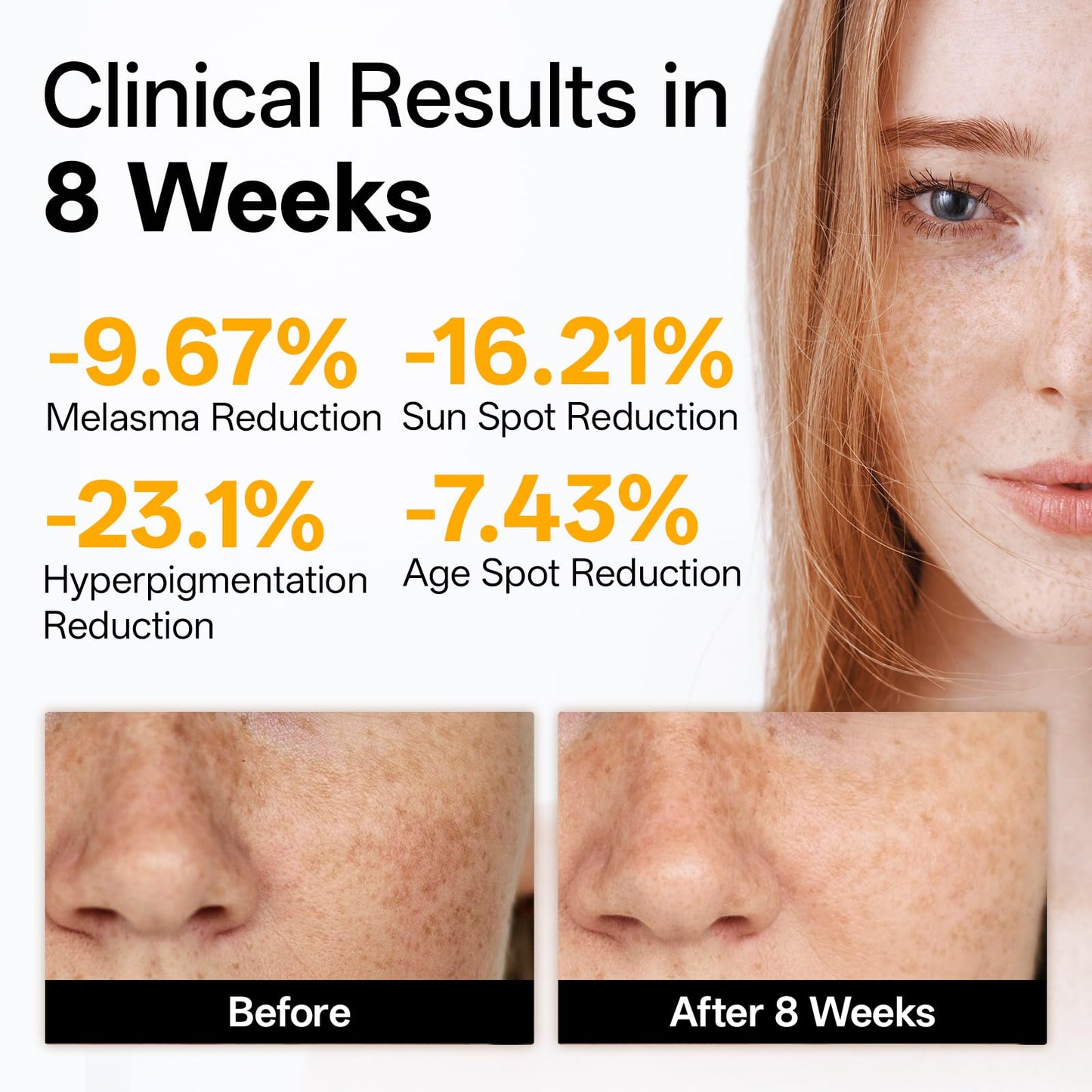 WNP Vitamin C Serum for Face – Dermatologist Tested Brightening Serum with Hyaluronic Acid & Vitamin E