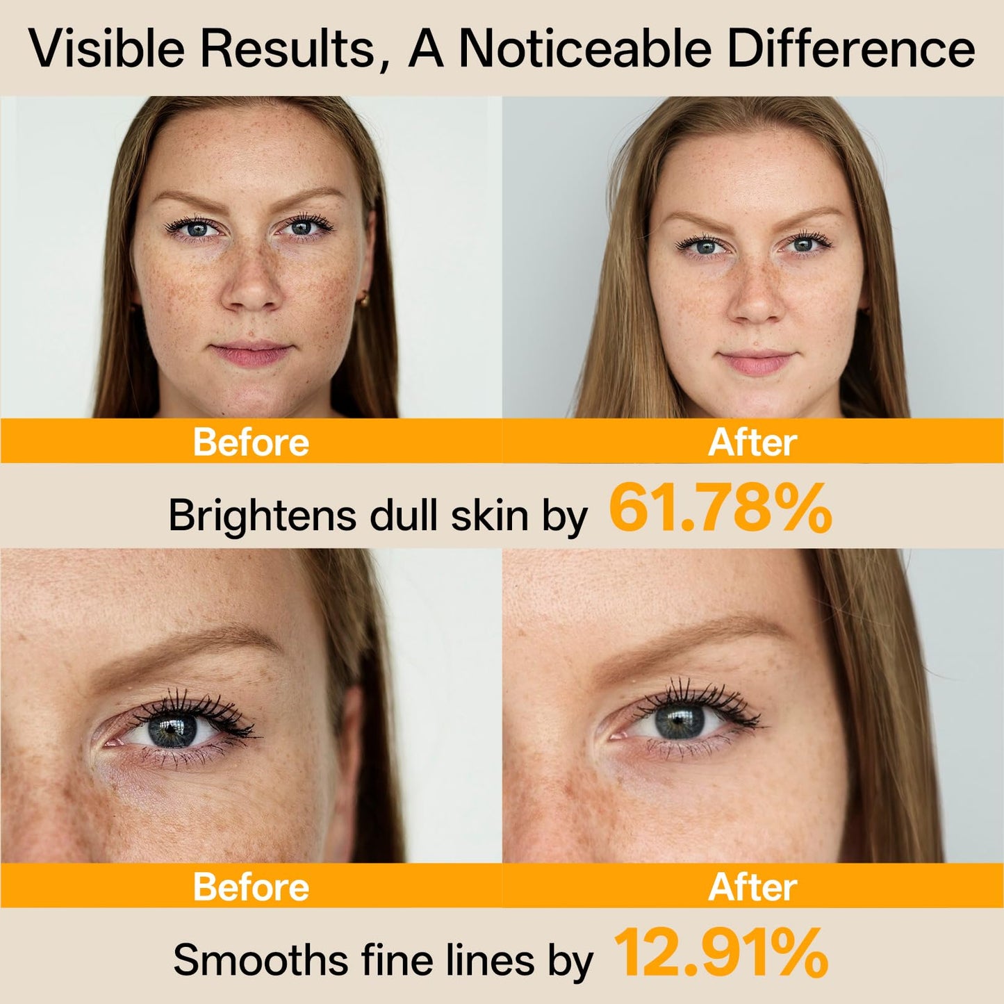 WNP Vitamin C Serum for Face – Dermatologist Tested Brightening Serum with Hyaluronic Acid & Vitamin E