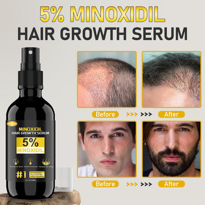 Wulumer Hair Growth Serum 5% Minoxidil for Men & Women | 2-Pack 120ml