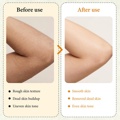 XILRVON Kojic Acid Turmeric Body Spray with Sponge – Exfoliating Mist with Retinol, Niacinamide, Glutathione – 100ml