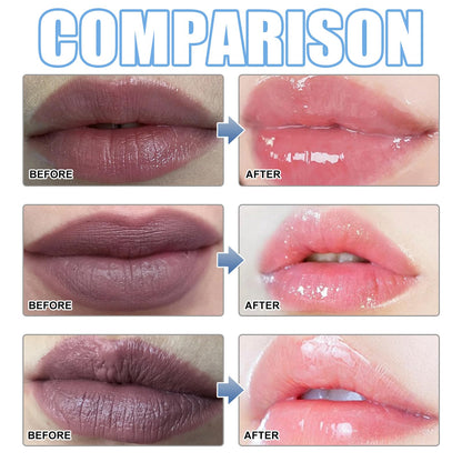 XIRUJNFD Lip Serum – Hydrating Dark Lip Brightening Treatment & Nourishing Lip Care