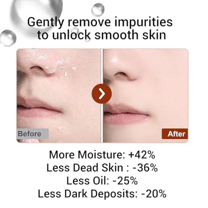 XOTMPFLY Black Rice Exfoliating Peel Shot – Gentle Facial Exfoliator