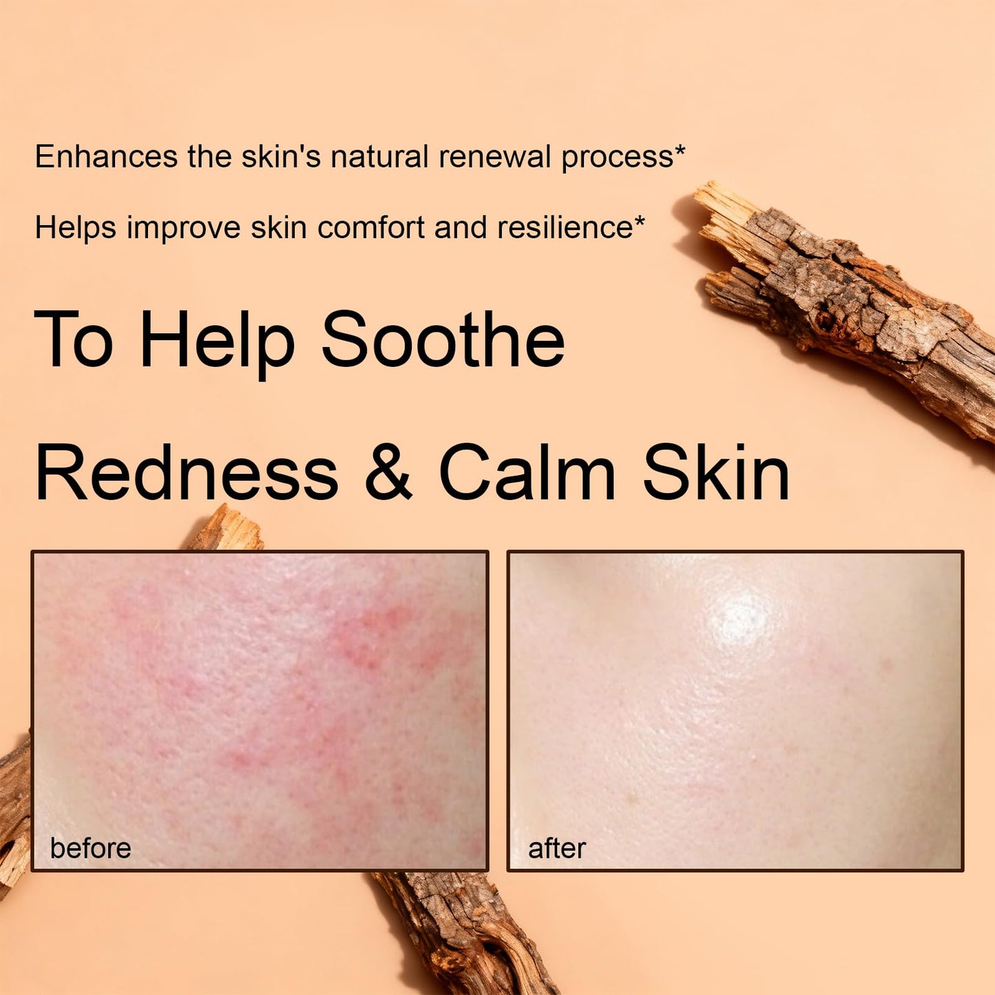 XUHUIT Advanced PDRN Rejuvenating Cream – 99% Salmon DNA, Hyaluronic Acid & Niacinamide