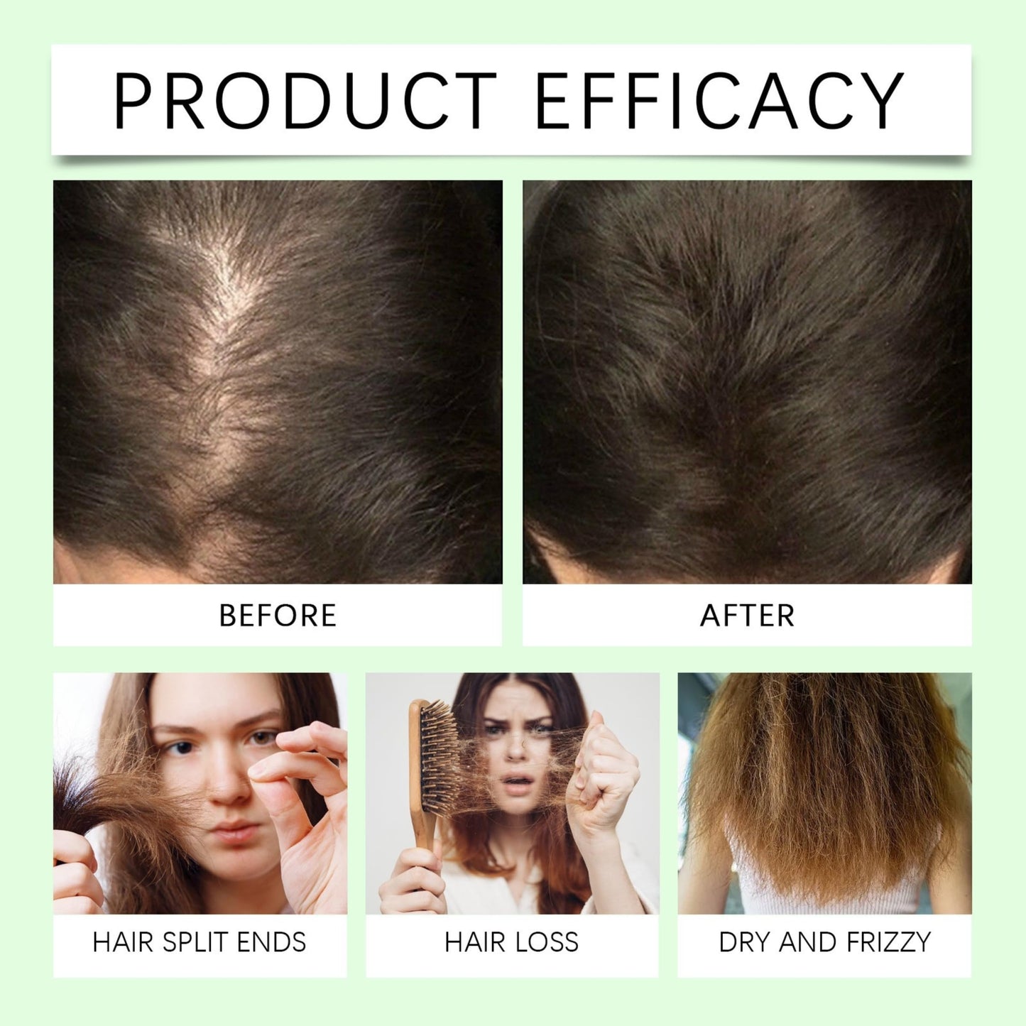 XYFSZDQJZHG Rosemary Hair Growth Shampoo – Keratin + Rosemary Oil for Thinning Hair (2 Pcs)