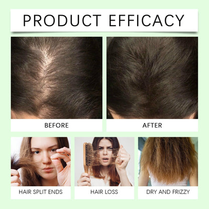 XYFSZDQJZHG Rosemary Hair Growth Shampoo – Keratin + Rosemary Oil for Thinning Hair (2 Pcs)