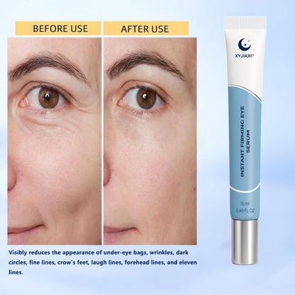 XYJIAXI Instant Firming Eye Serum – Quick Lift & Long-Lasting Firmness (15 ml, 0.49 oz)