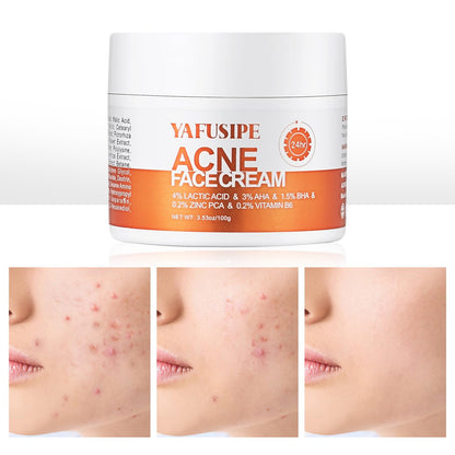 YAFUSIPE Acne Treatment Cream for Cystic Breakouts – Gentle, All-Skin-Types Formula