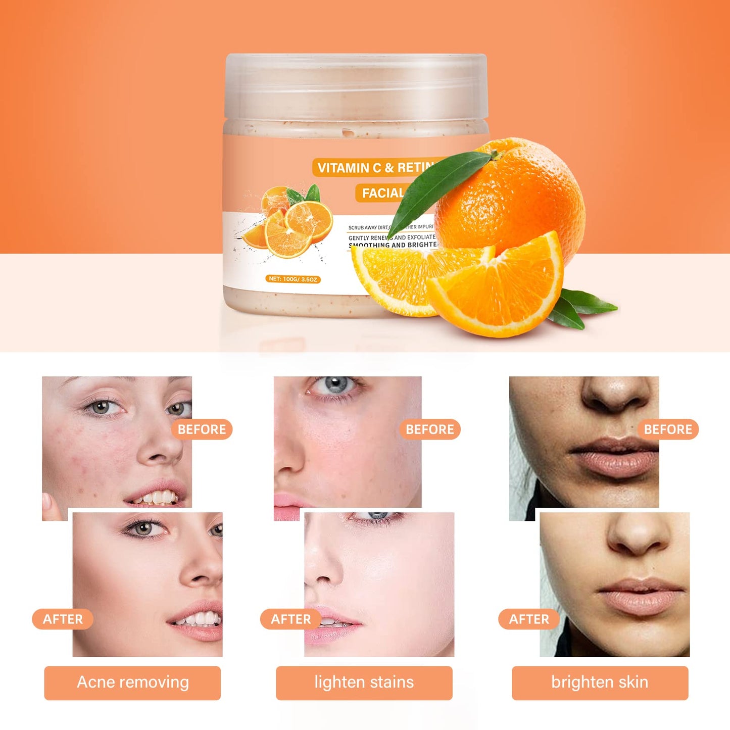 YAFUSIPE Gommage Visage Vitamin C et Retinol – Exfoliant Doux 3,5 oz