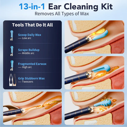 Yakbio Ear Cleaner with Camera 1296P HD - 6 LED Lights, Wireless Ear Wax Removal Kit