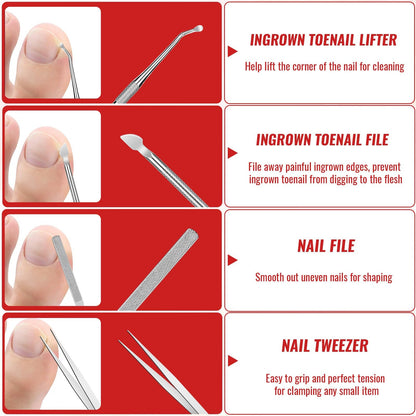 YEQOIZ Ingrown Toenail Removal Kit — All-In-One Home Care Tools