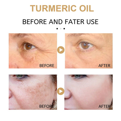 YG LianKai Turmeric Dark Spot Corrector Serum Oil - 2 Pack, 30ml