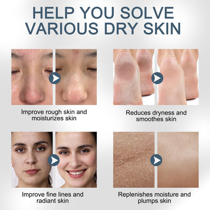YMEYFAN Pure Hyaluronic Acid Powder for DIY Serums – 33 oz Yield, Cosmetic Grade, Non-GMO