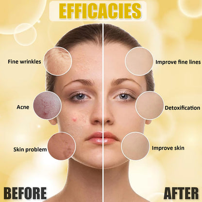 YMEYFAN Turmeric Jelly Mask Powder — Deep Cleansing & Oil Control (500g/17.6oz)