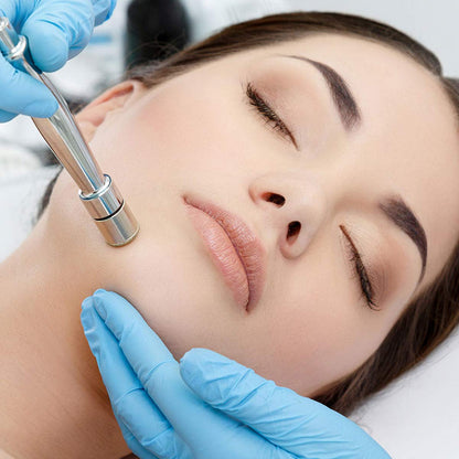 Yofuly Diamond Microdermabrasion Machine — 65-68 cmHg Suction for Home Use