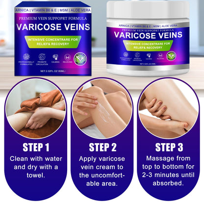 Yongsenina Varicose Veins Cream for Legs – Lightweight, Non-Sticky Vein & Spider Vein Treatment