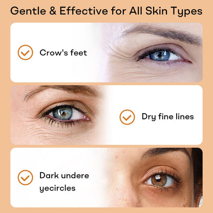 YoPoll Instant Eye Lift Cream – Temporary Under-Eye Tightener & Hydrating Primer with Hyaluronic Acid