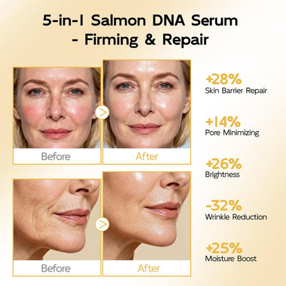YouthVibe 0.5% PDRN Serum for Face – Anti‑Aging Salmon DNA Serum with HA, Niacinamide & Squalane, 30ml