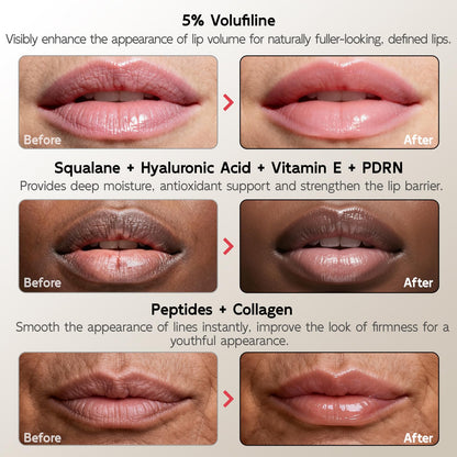 YouthVibe 5% Volufiline Lip Plumper – Gentle Daily Plumping with Squalane, Peptides & PDRN